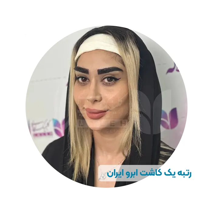 کاشت ابرو لاله