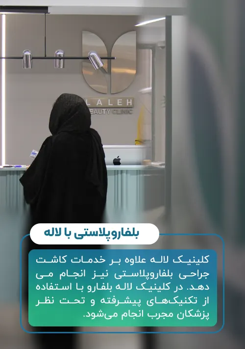 بلفاروپلاستی در کلینیک لاله