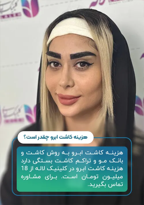 هزینه کاشت ابرو