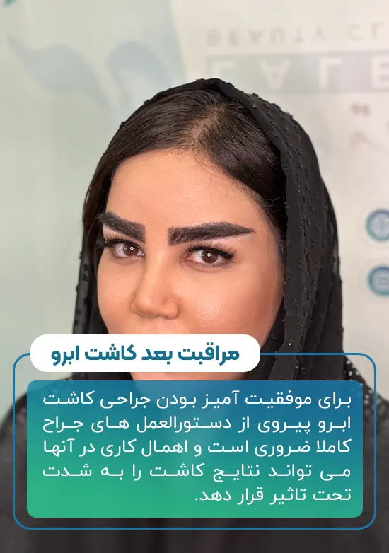 مراقبت بعد کاشت ابرو
