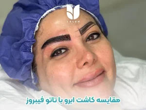 مقایسه کاشت ابرو با تاتو، فیبروز و میکرو ابرو