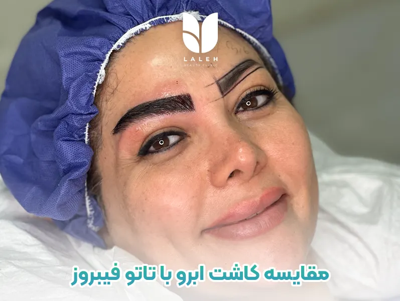 مقایسه کاشت ابرو با تاتو، فیبروز و میکرو ابرو