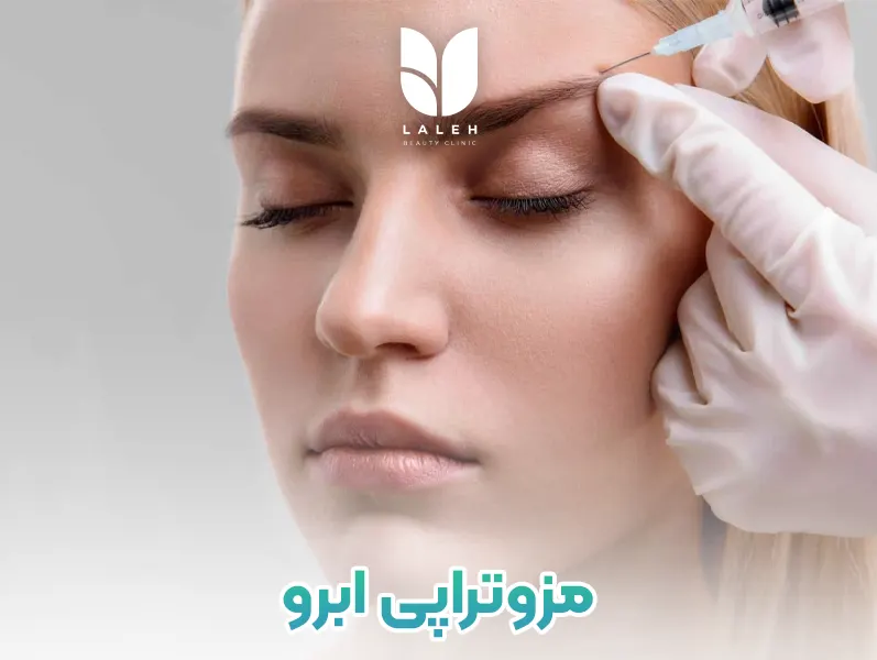 مزوتراپی ابرو