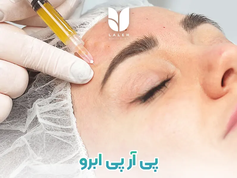 پی آر پی ابرو