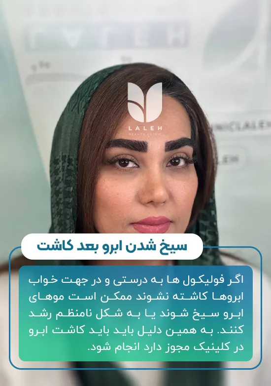 دلیل سیخ شدن ابرو بعد کاشت