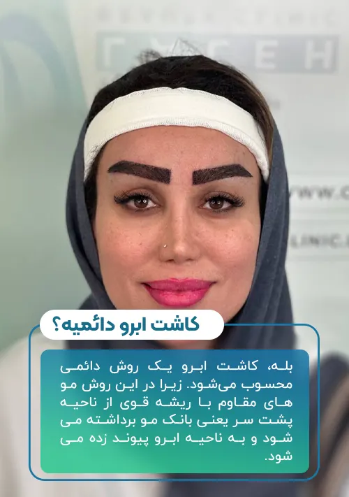 ماندگاری کاشت ابرو چقدر است؟