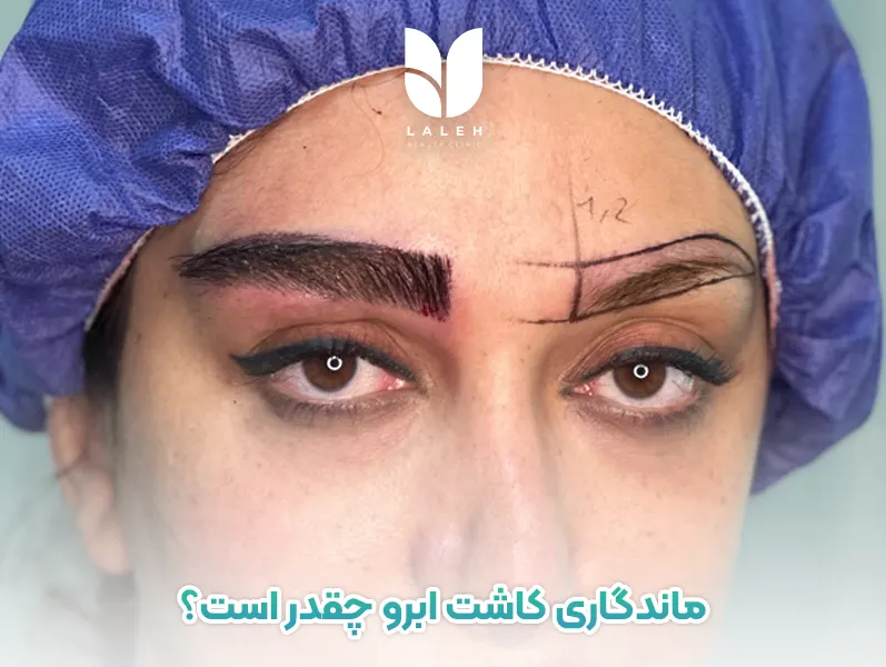 ماندگاری کاشت ابرو چقدر است؟