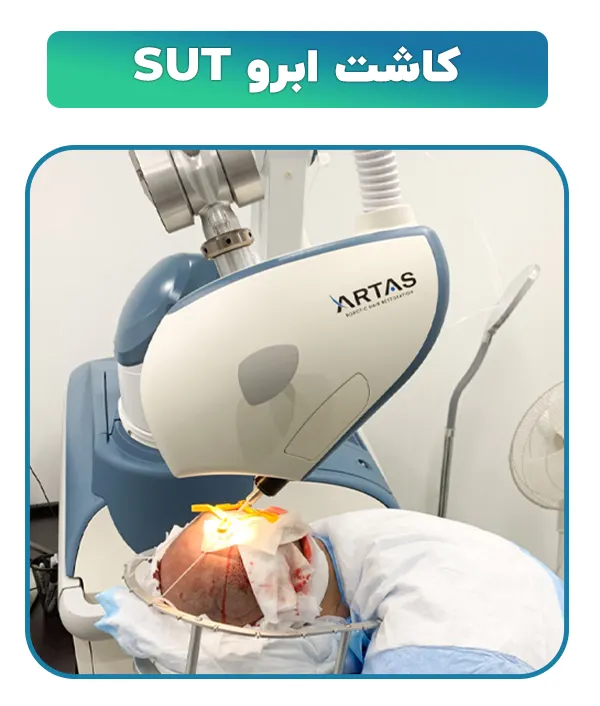 کاشت ابرو SUT