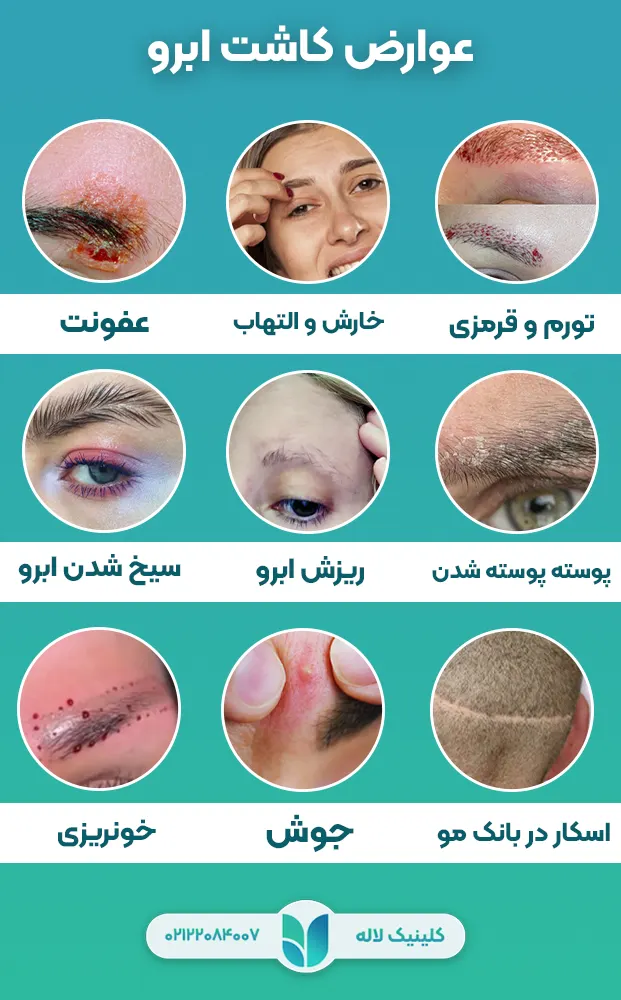کاشت ابرو چه عوارض دارد؟
