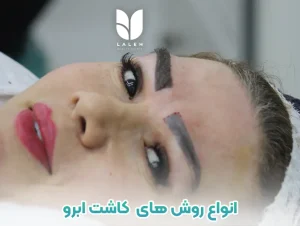 مقایسه روش های مختلف کاشت ابرو