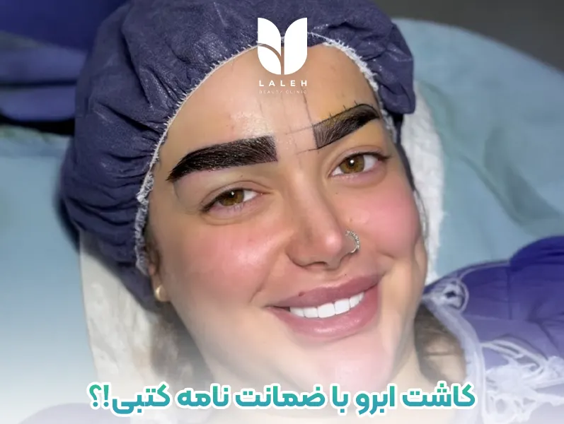 کاشت ابرو با ضمانت نامه کتبی ممکن است؟