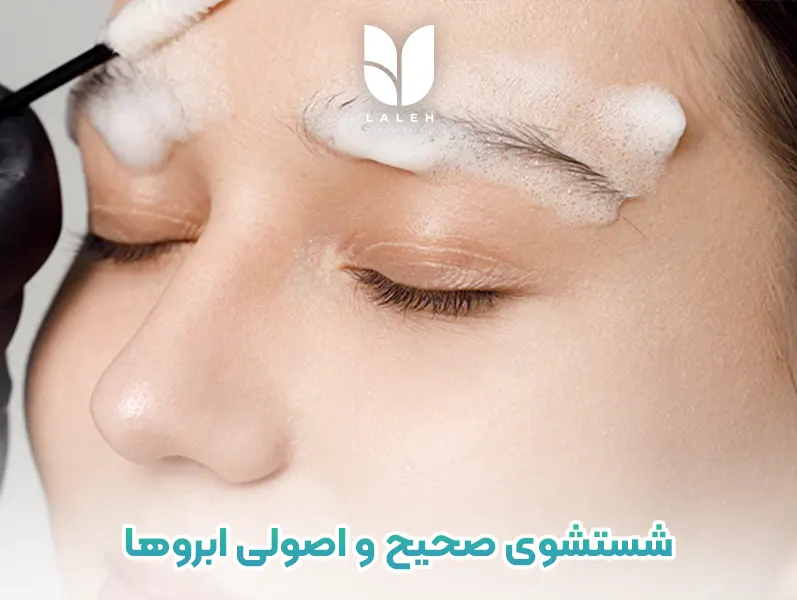 شستشو ابرو بعد کاشت