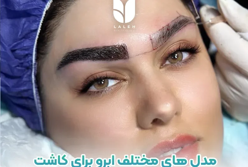 مدل های مختلف ابرو برای کاشت