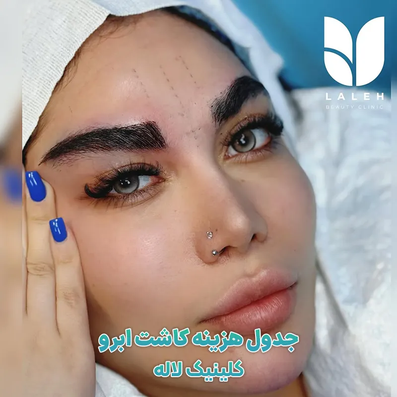 هزینه کاشت ابرو در کلینیک لاله