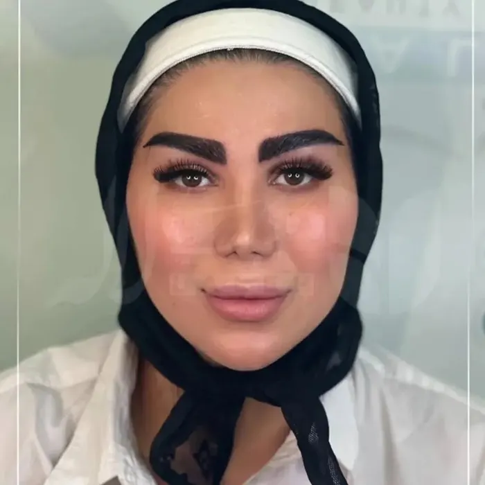نمونه کاشت ابرو