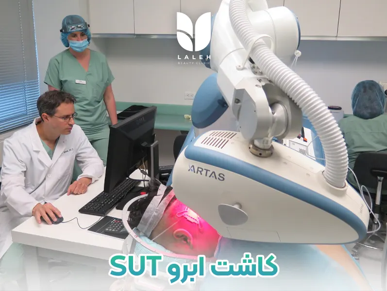 کاشت ابرو SUT