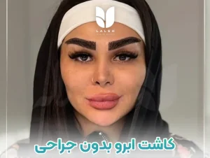 کاشت ابرو بدون جراحی