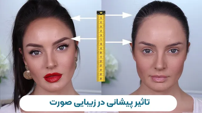 تاثیر اندازه پیشانی در زیبایی