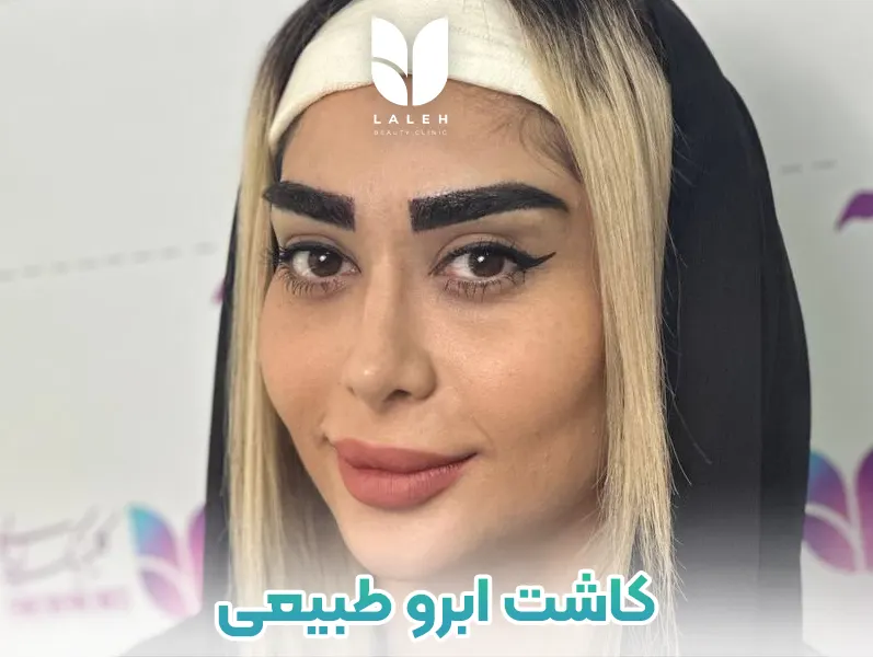 کاشت ابرو طبیعی