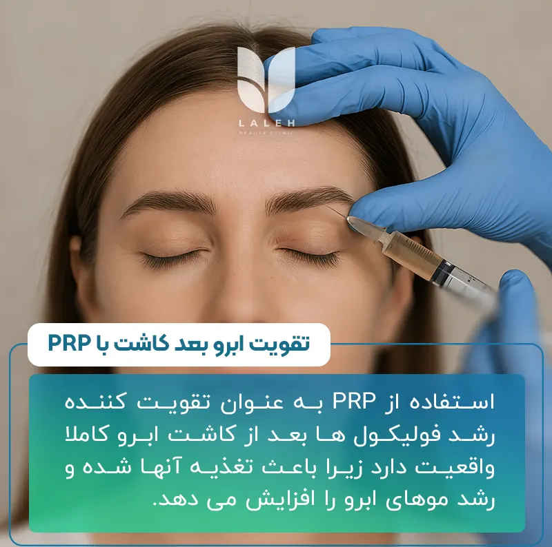 تقویت ابرو با پی آر پی