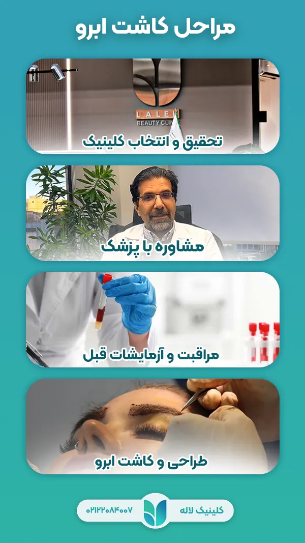 مراحل کاشت ابرو