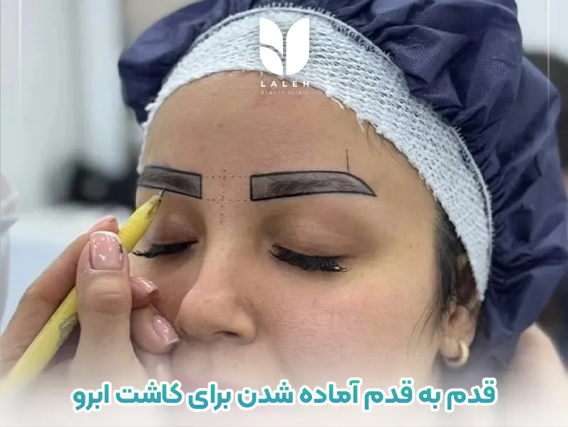 قدم به قدم آماده شدن برای کاشت ابرو