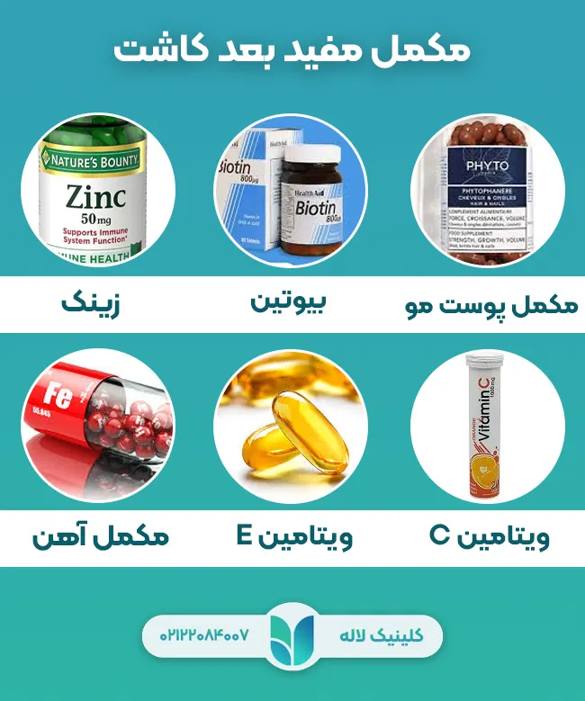 مکمل های مفید بعد کاشت ابرو