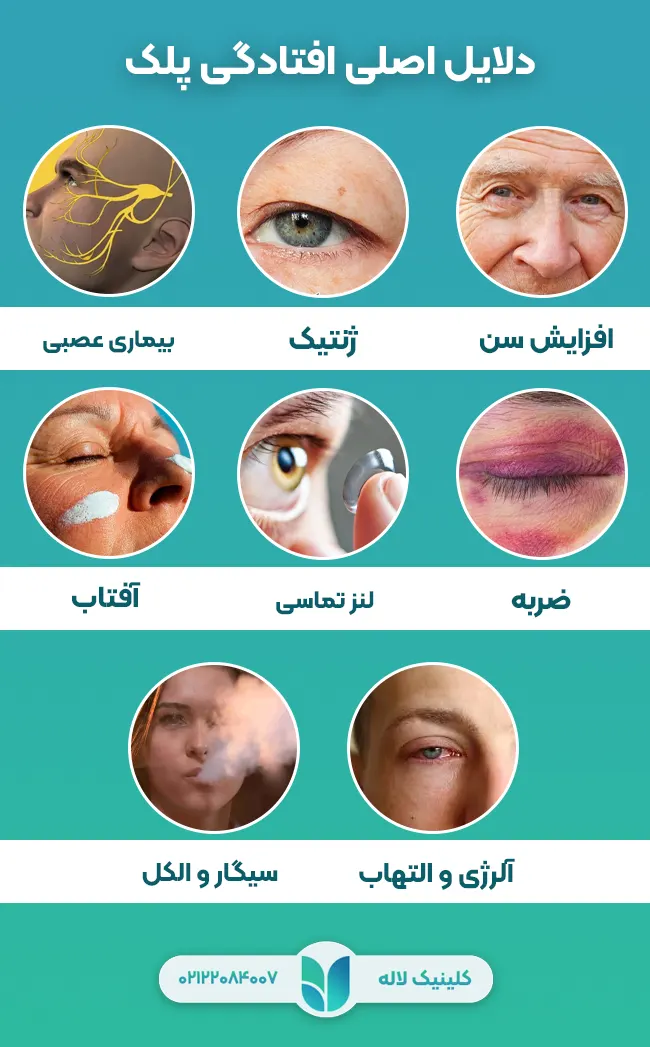 دلایل اصلی افتادگی پلک
