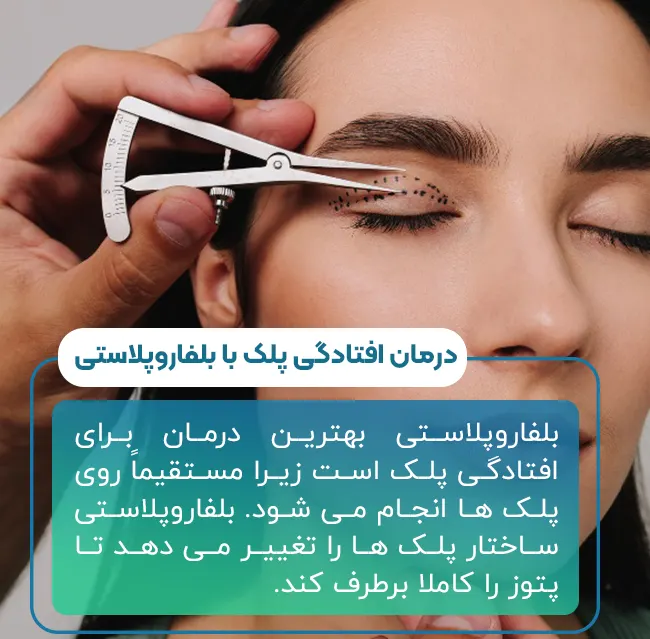 بلفاروپلاستی