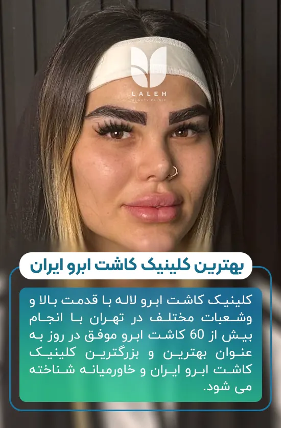 کاشت ابرو در کلینیک لاله