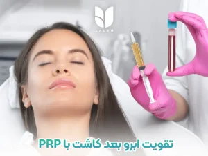 تقویت ابرو بعد کاشت با PRP