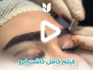 فیلم صفر تا صد کاشت ابرو