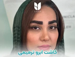 کاشت ابرو ترمیمی