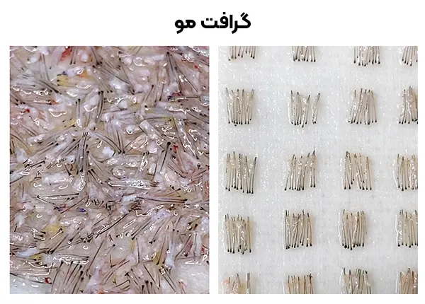 گرافت مو