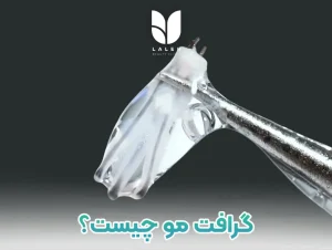 گرافت مو