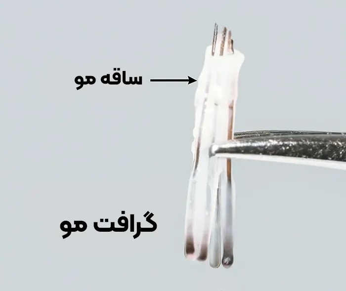گرافت مو