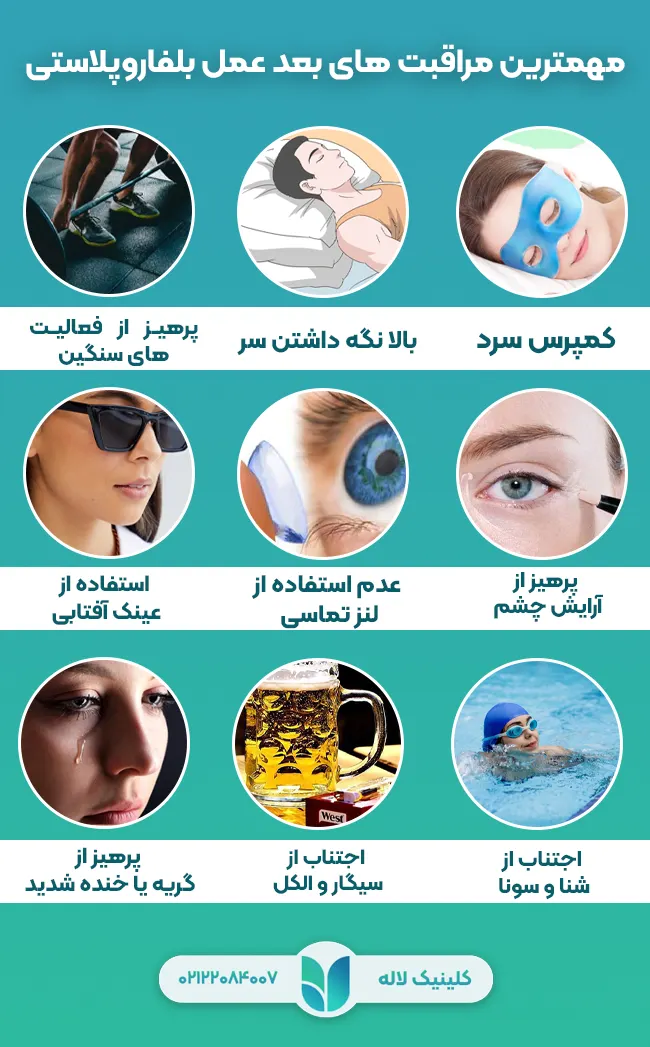 مراقبت های بعد عمل بلفاروپلاستی