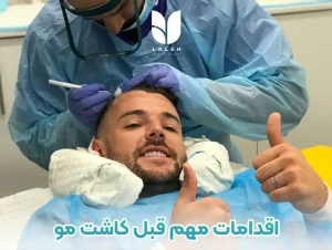 اقدامات مهم قبل کاشت مو