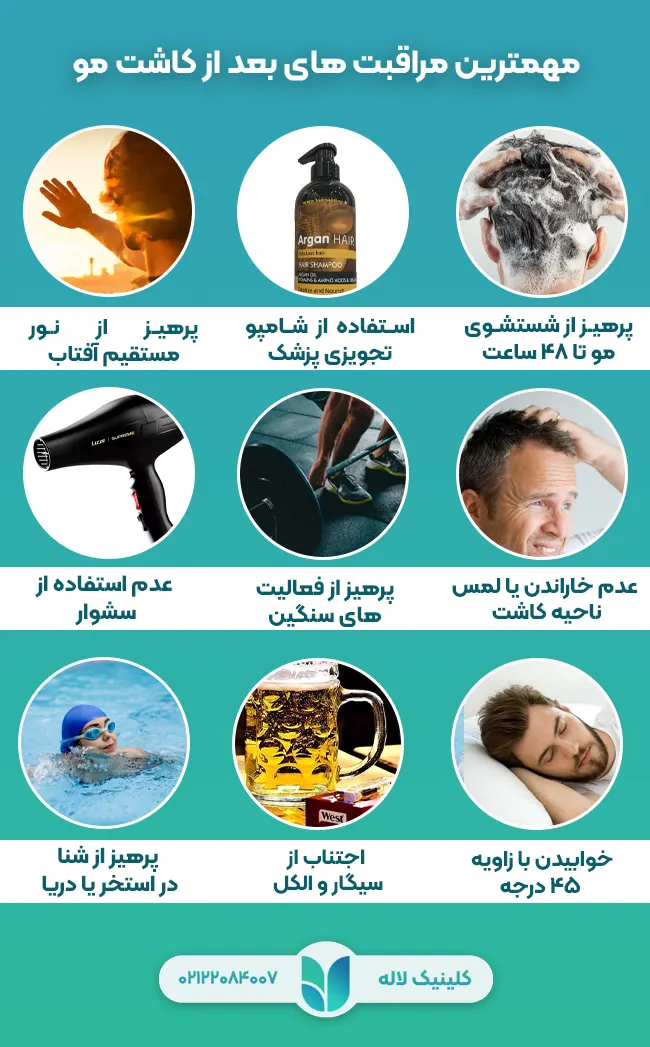 مهمترین مراقبت های بعد از کاشت مو