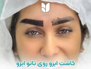 کاشت ابرو روی تاتو ابرو