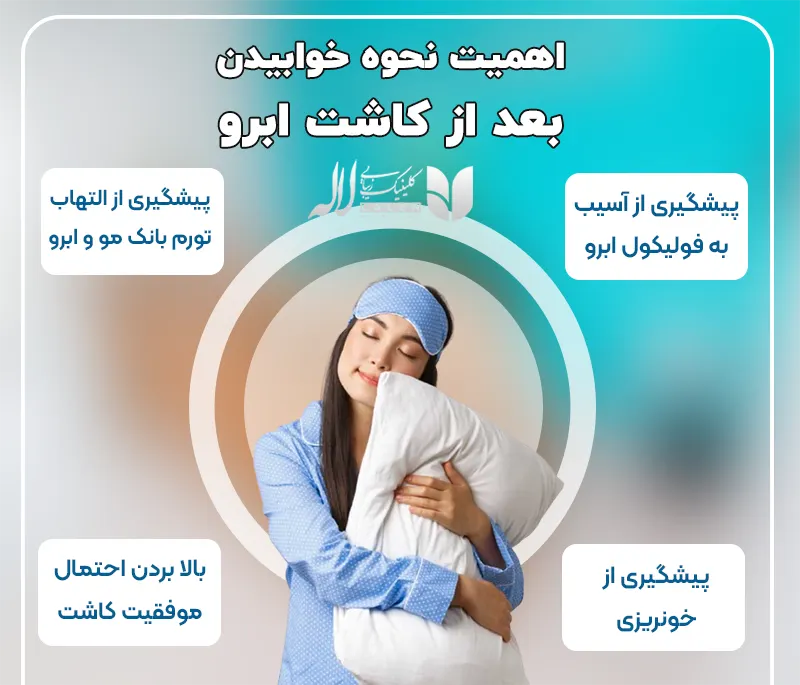 نحوه خوابیدن بعد از کاشت