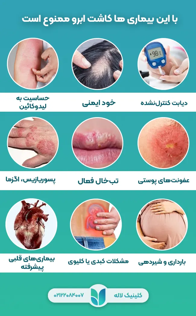 با این بیماری ها کاشت ابرو ممنوع است