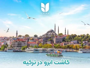 کاشت ابرو در ترکیه