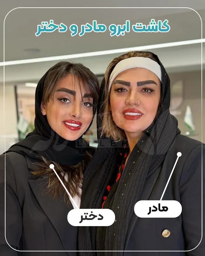 کاشت ابرو دخترانه