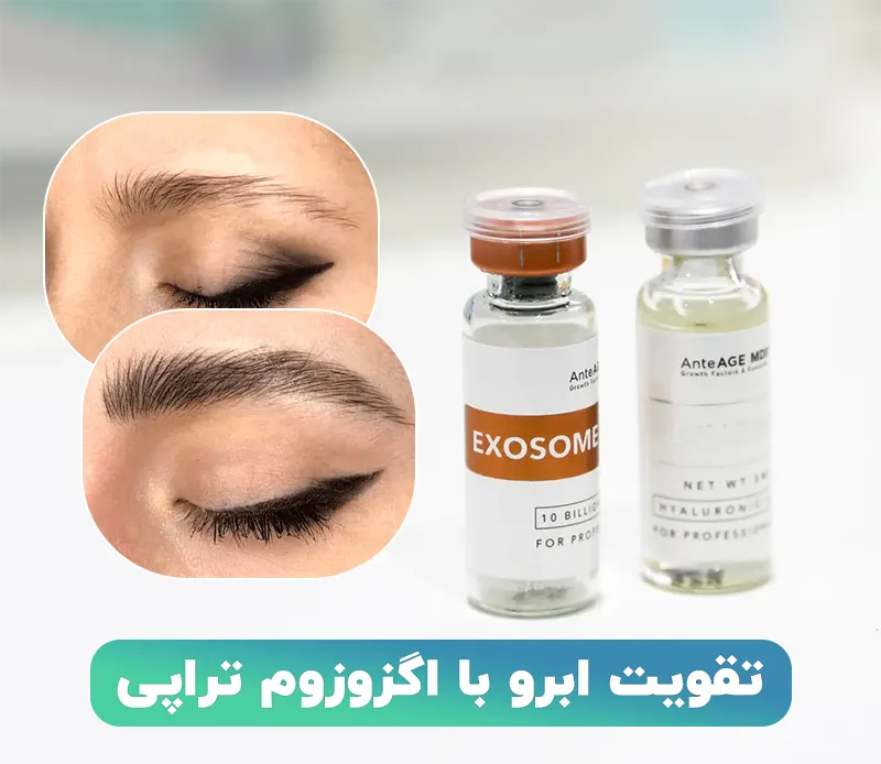 تقویت ابرو با اگزوزوم تراپی