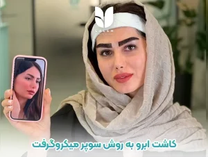 کاشت ابرو به روش سوپر میکروگرفت