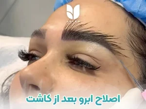 اصلاح ابرو بعد از کاشت