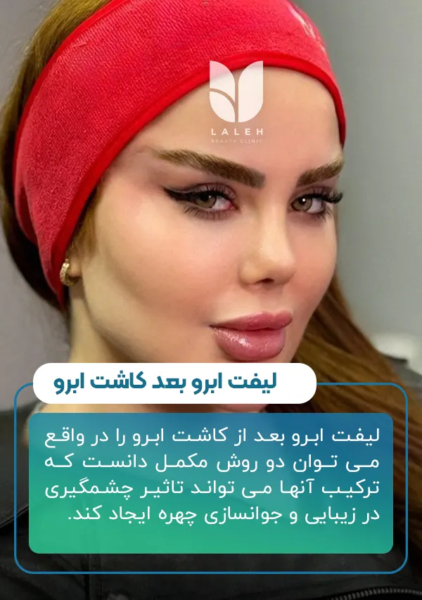 لیفت ابرو بعد کاشت ابرو