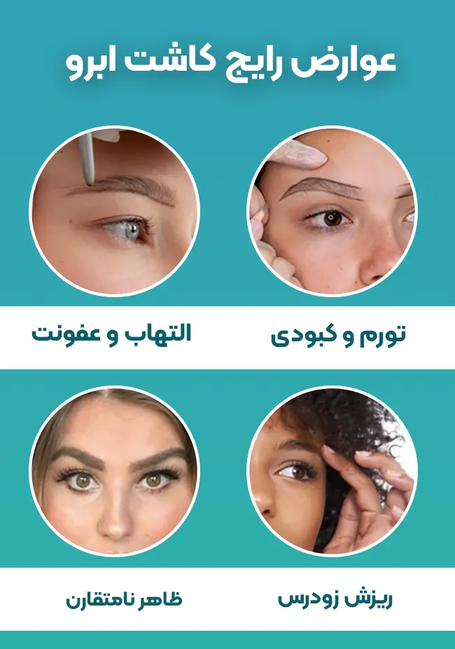 عوارض رایج کاشت ابرو