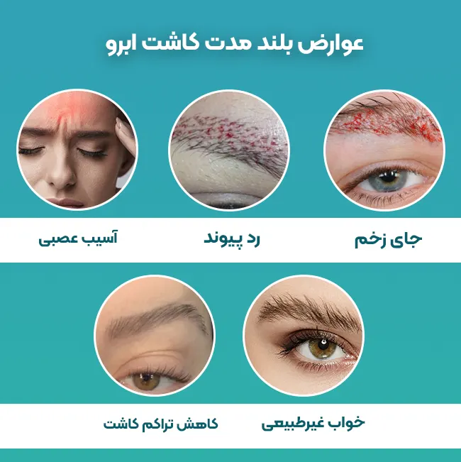 عوارض بلند مدت کاشت ابرو